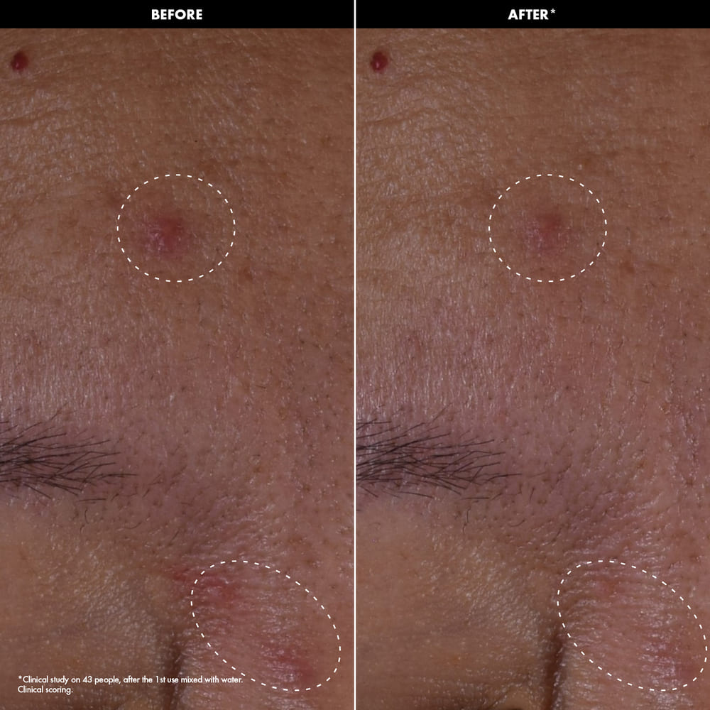 CLEAR & CORRECT ACTIVE POWDER (POLVO ANTIIMPERFECCIONES CON &Aacute;CIDO MAND&Eacute;LICO Y ECTO&Iacute;NA)